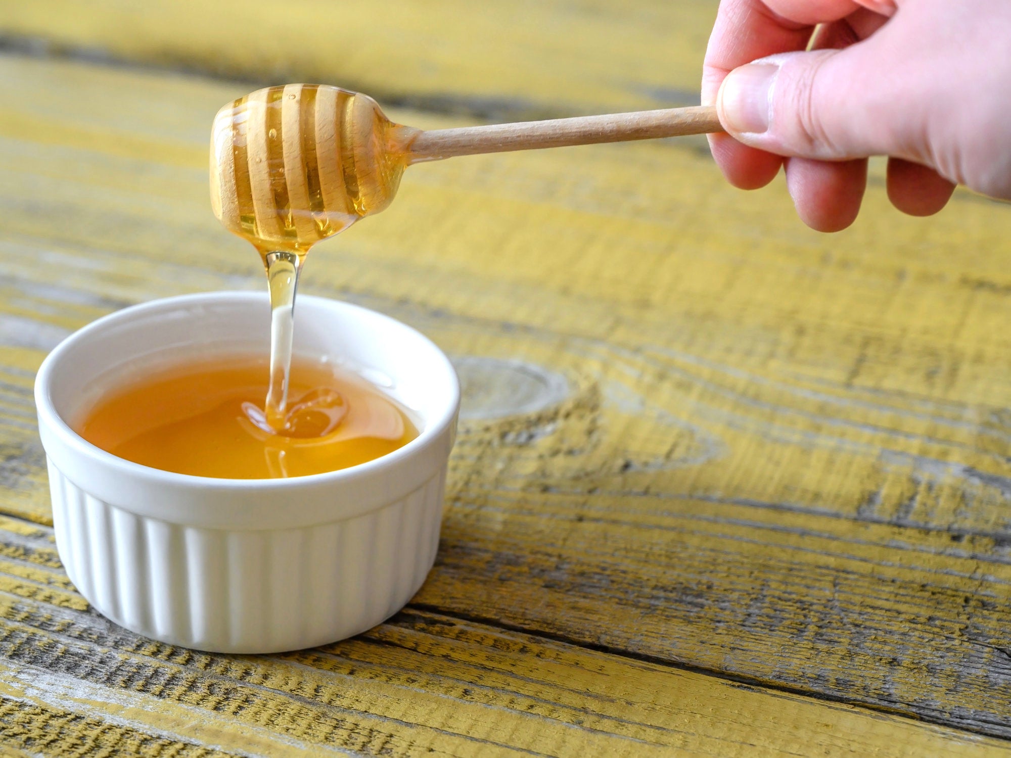 Manuka honey on burns and minor burns