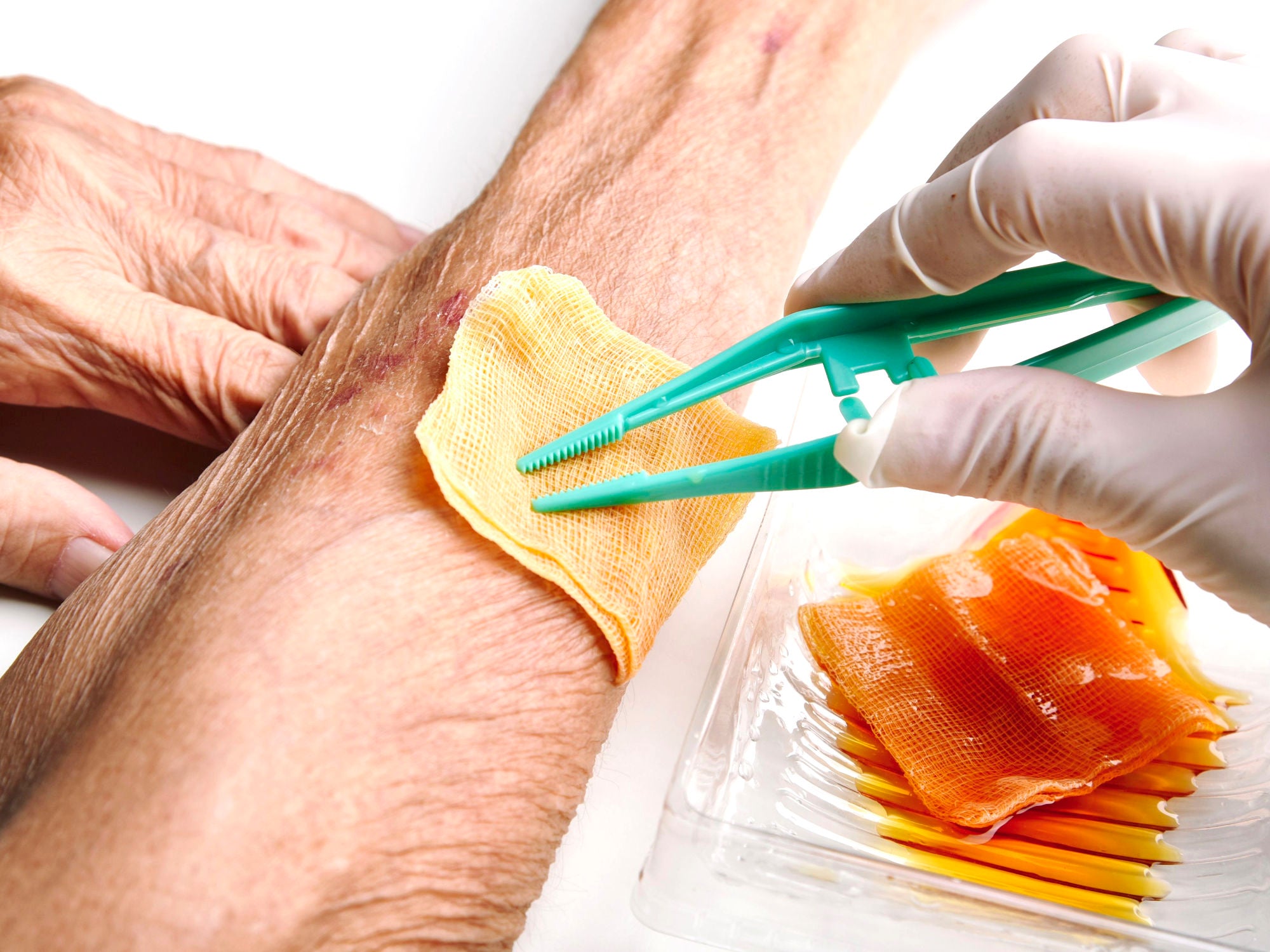 How to apply Manuka Honey on wounds
